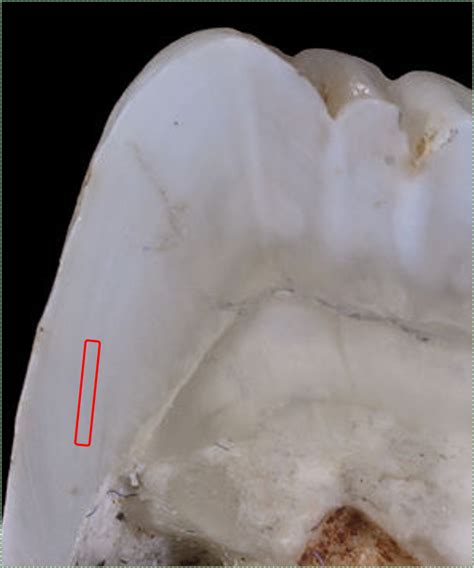 Enamel Development Histology And Embryology For Dental Hygiene