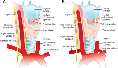 Recurrent Laryngeal Nerve