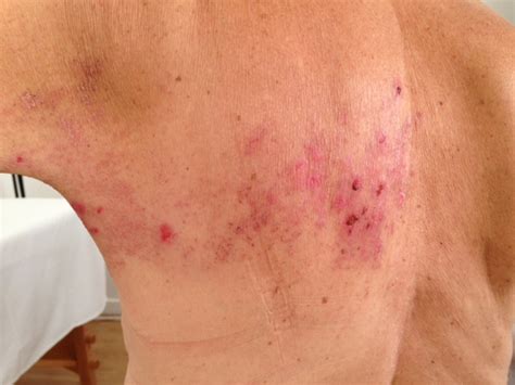 guerisseur-rebouteux