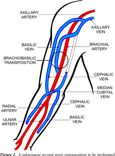 Figure From Axillary Artery Brachial Artery Radial Artery Ulnar