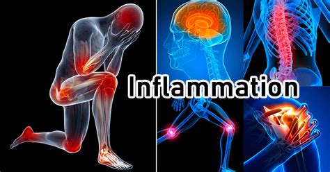 What Is Inflammation An Introduction Microbe Notes