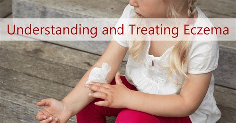 Treating Eczema In Toddlers And Infants Ask Dr Sears