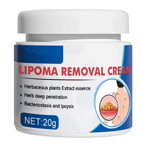 20g Lipoma Removal Cream Herbal Extract Care Fat Bulges Lump Remove