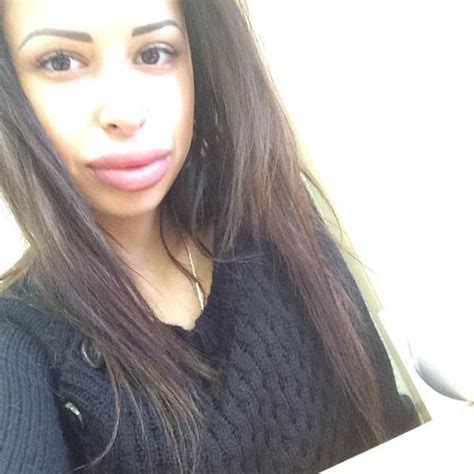 anya flaunts her massive fake lips 21 pics