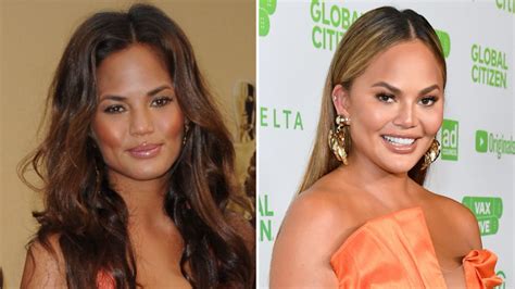Has Chrissy Teigen Had Plastic Surgery From Breast Implants To Buccal