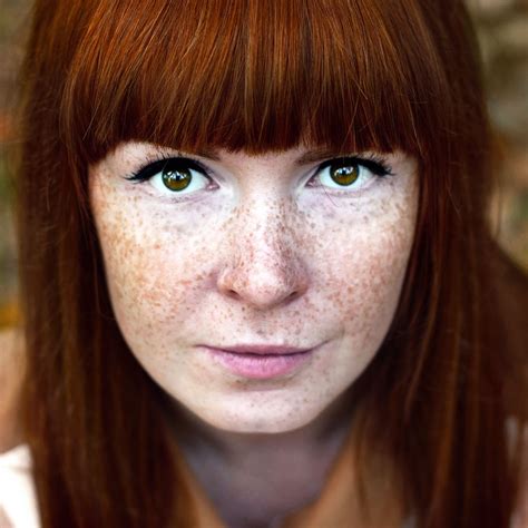 Calls Freckles Imperfections Incites Hate Us Weekly