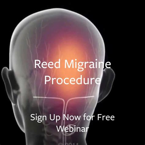 Reed Migraine Procedure Reed Migraine Procedure Featured On Fox News