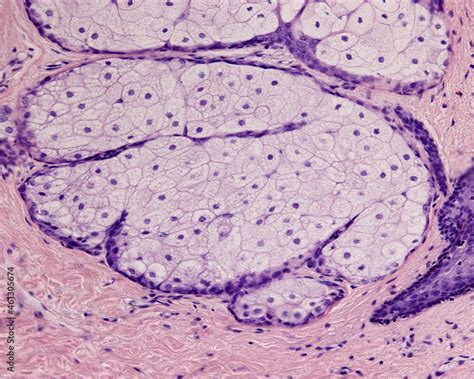 Human Skin Sebaceous Gland Foto De Stock Adobe Stock