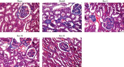Effects Of Resveratrol On Renal Interstitial Fibrosis In Kidney Of