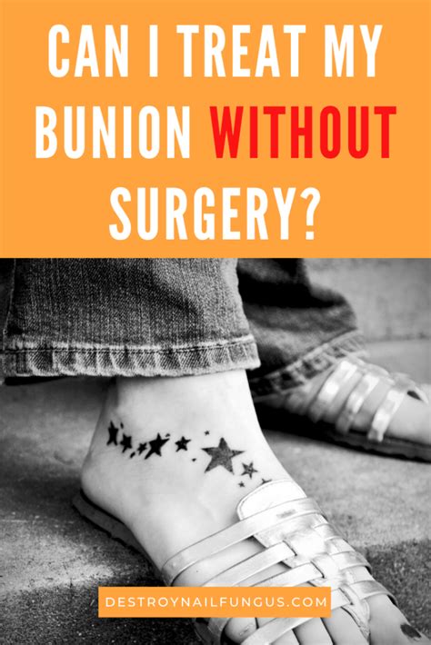 A bunion on the big toe is called a hallux valgus deformity; Can Bunions Be Reversed? Everything You Need To Know