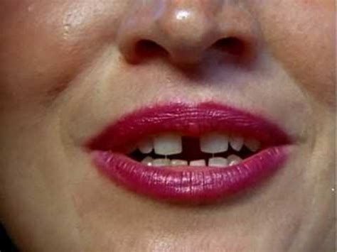 The gap in the front teeth is called diastema in dental terminology. Gap-Toothed Women (1987) - YouTube