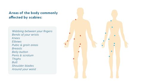 Very Early Scabies Scabies Images Symptoms And