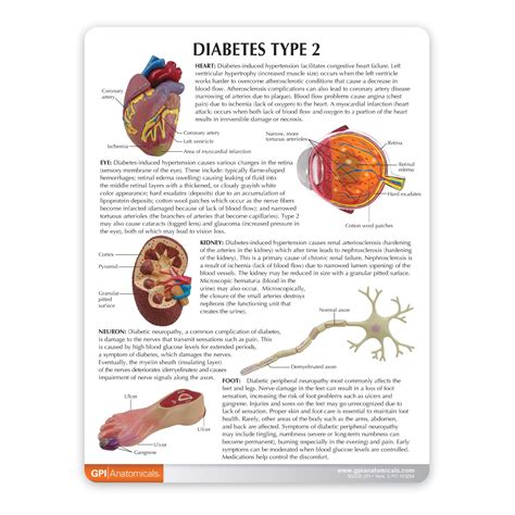 Diabetes Model Set Human Body Anatomy Replica Of The Effects From