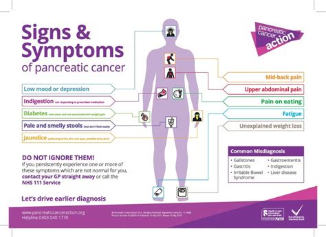 Surgery to relieve signs and symptoms. Symptoms Poster · Pancreatic Cancer Action