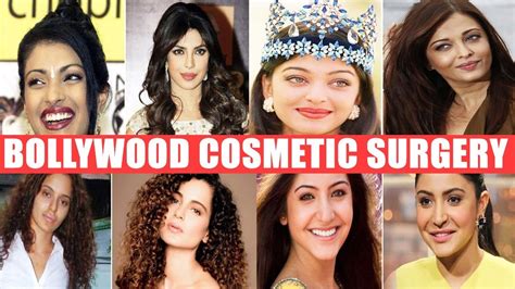 Bollywood Celebrity Plastic Surgery Before And After Youtube
