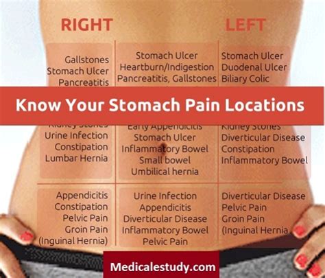 Find Out Locations Of Stomach Pains Nursing Mnemonic