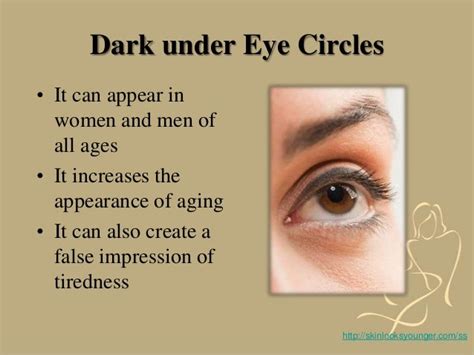 What Causes Dark Circles Under Eyes Find Out