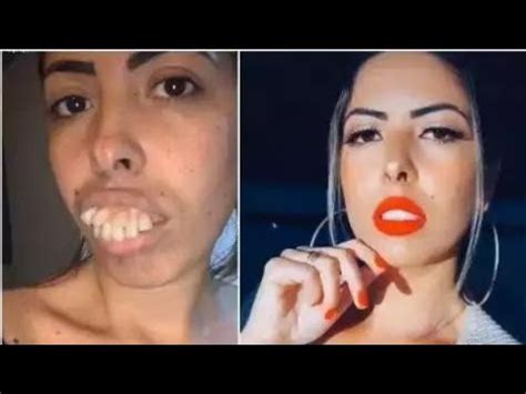 Woman S Amazing Teeth Transformation Gets Millions Of Views But