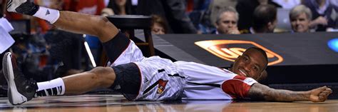 Kevin Ware S Leg Fixed Funny