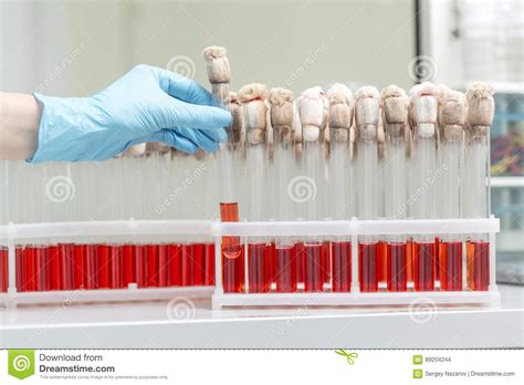 Hand Of A Lab Technician Holding Blood Tube Test And Background A Rack