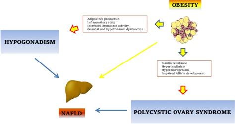 sex hormones abnormalities in non alcoholic fatty liver disease pathophysiological and clinical