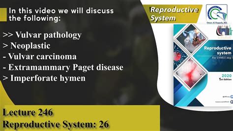 Vulvar Carcinoma Extramammary Paget Disease Imperforate Hymen YouTube
