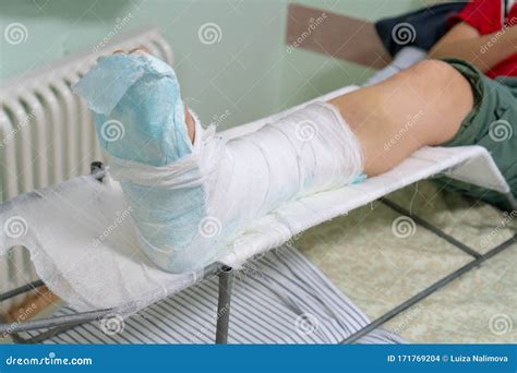 Broken Leg Cast In Bed