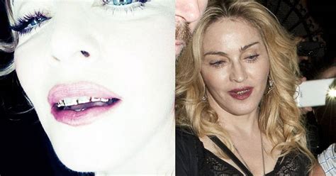 Madonna Flashes Golden Grills With Diamond Stone Embellishments