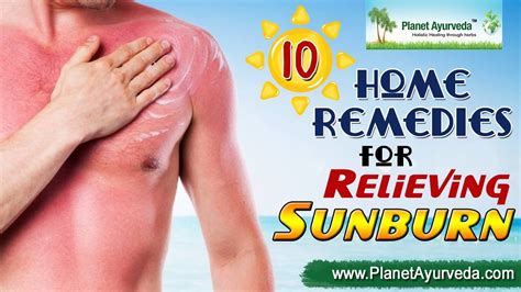10 Home Remedies For Sunburn Relief Sunburn Treatment Youtube