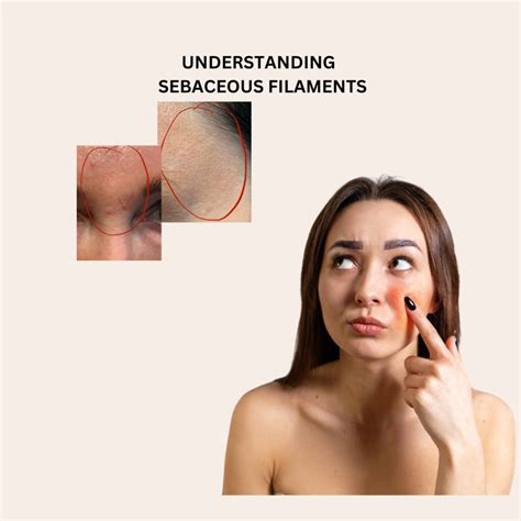 Are Sebaceous Filaments The Reason You Have Oily Skin The Naked Chemist