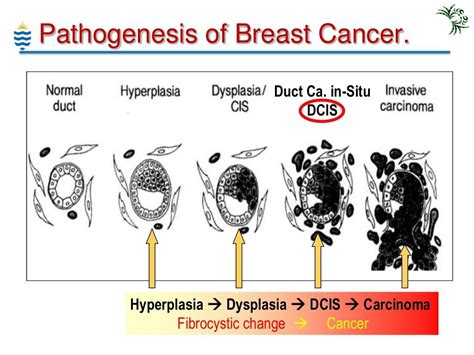 Ppt Breast Pathology Lecture 2013 Powerpoint Presentation Free