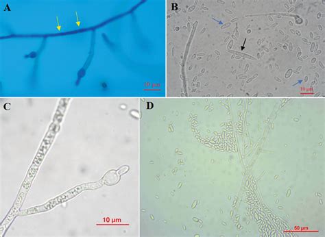 Microscopic Appearance Of Fusarium Oxysporum Isolated From Wild