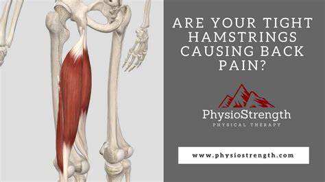 Are Your Tight Hamstrings Causing Back Pain Youtube