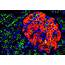 A Boost For Beta Cells  ELife Science Digests