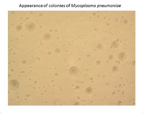 Appearance Of Colonies Of Mycoplasma Pneumoniae Colonies Of M