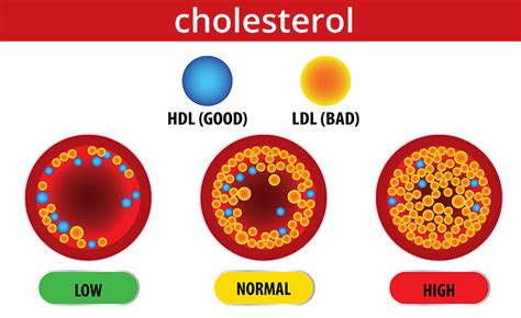 High Cholesterol Symptoms Causes Treatment Heart Foundation