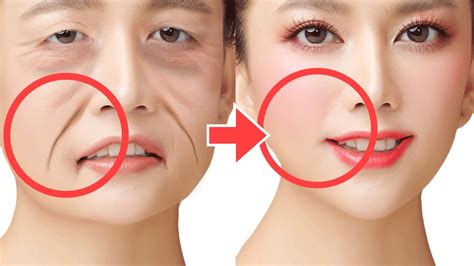 5mins Smile Lines Facial Exercises For Beginners Nasolabial Folds