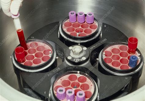 Blood Samples Being Loaded Into A Centrifuge Stock Image M5300324