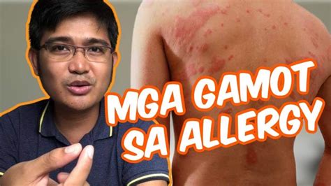 Mabisang Gamot Sa Allergy Sa Balat Medisinagamot