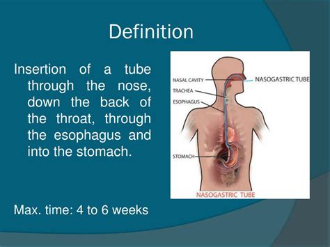 Nasogastric Tube Insertion Ppt Gastrointestinal Intubation The Best