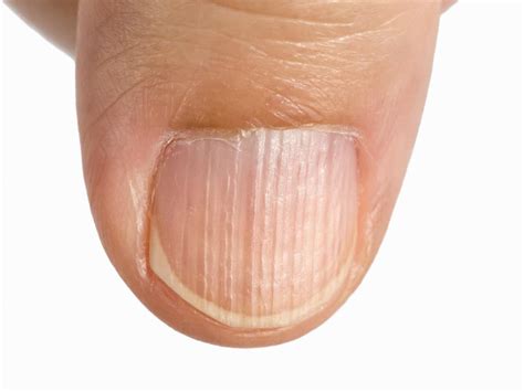 Bruzdy na paznokciach co oznaczają To wyczytasz z wyglądu paznokci