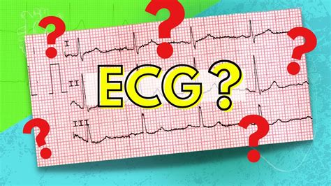 048 How To Read An Electrocardiogram Ecgekg Youtube