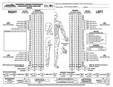 Management Of Spinal Cord Injuries Asia Scoring Example Physiopedia