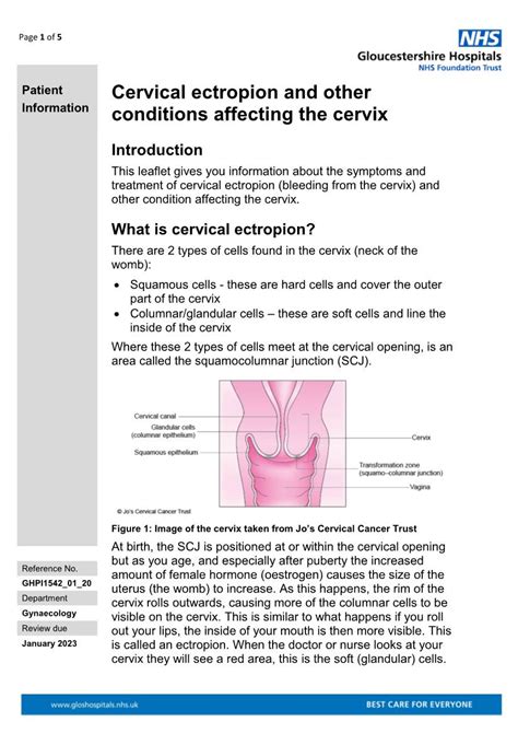Cervical Ectropion And Other Conditions Affecting The Cervix Docslib