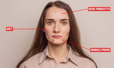 Expert Reveals The Causes Of Bad Skin On Different Parts Of The Face