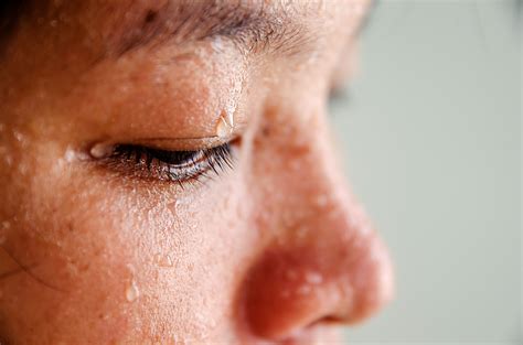 Heavy Sweating In Fibromyalgia And Cfs