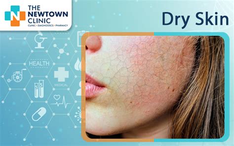 Dry Skin Symptoms Causes Diagnosis And Treatment