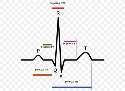 Sinus Rhythm Electrocardiography Heart Rate Sinus Tachycardia Png