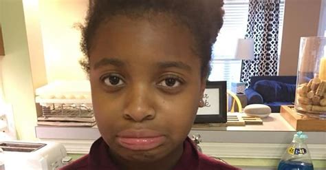 White Mom Says Maryland Clinic Refused To Treat Black Daughter Huffpost