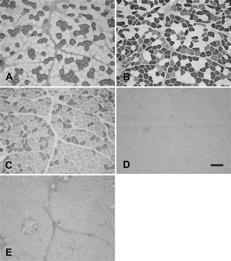 Photomicrographs Of Immunoperoxidase Stained Semiserial Sections Of The